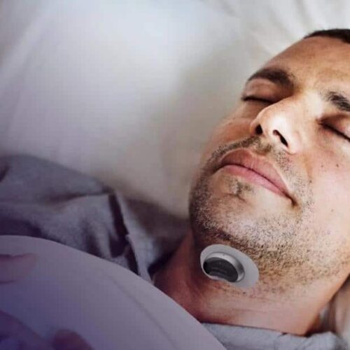 (10Pairs/20PCS) Anti-Snoring Device Electrode Pads