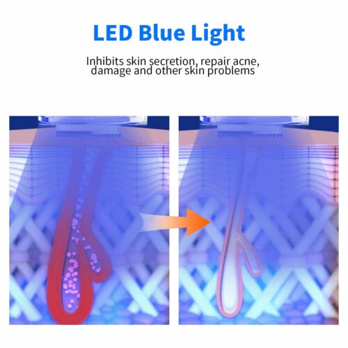 Everbelle™ Official Retailer – Nano Microneedling Pen + Led Therapy