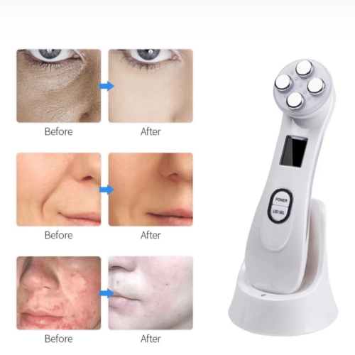 Luminous Beauty Face Lift™ – Official Retailer