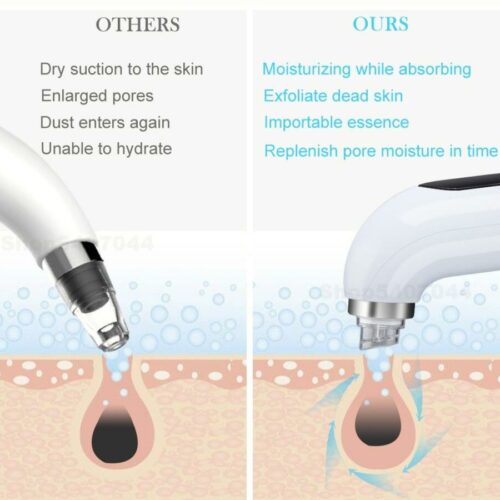 lumos glow™ hydrodermabrasion – official retailer (copy)