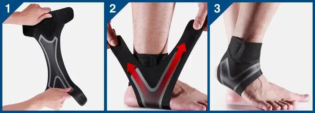 How Plantar X Wrap™ Works
