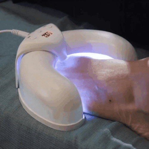 Okita Nail Fungus Light (Official Retailer) 2025