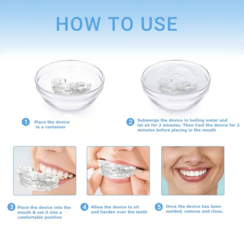 DreamHero Mouth Guard (Official Retailer) 2025