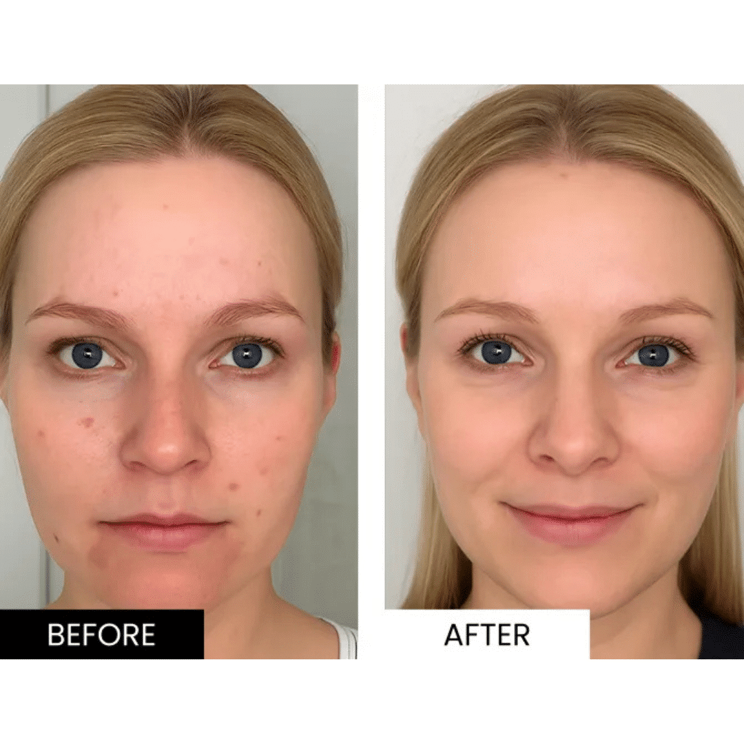 Glokore LED Mask (Official Retailer) 2025