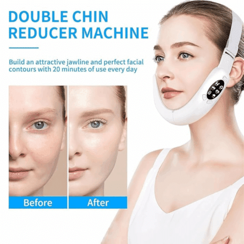 SlimDefine Face Massager (Official Retailer) 2026