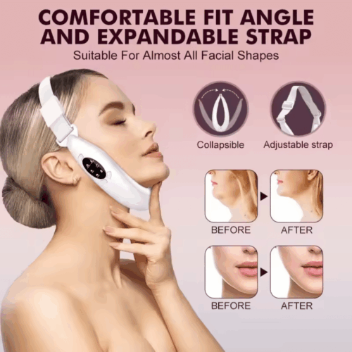 SlimDefine Face Massager (Official Retailer) 2026