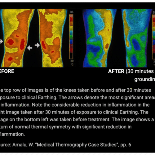 BareEarth Grounding Mat (Official Retailer) [year]