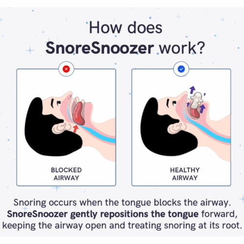 SnoreSnoozer Pro (Official Retailer) [year]