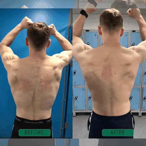 AlignPro (Official Retailer) [year]