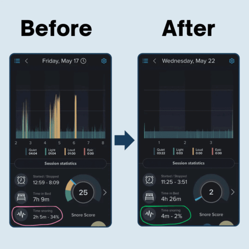 SnoreSnoozer Pro (Official Retailer) [year]