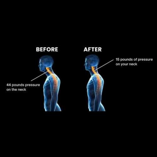 CerviCalm™ Therapeutic Neck Massager (Official Retailer) [year]